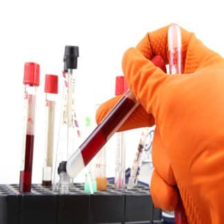 Subsidie voor het aanpakken van sikkelcelziekte met biotechnologie